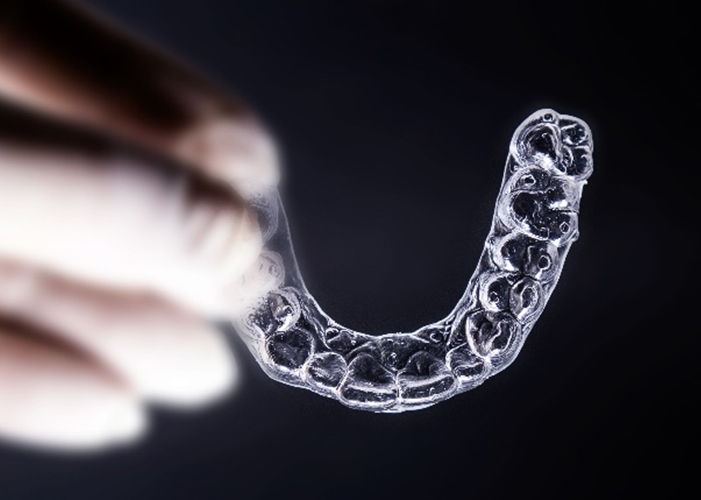 무삭제 라미네이트